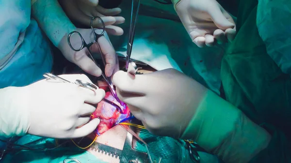 Dettaglio di un intervento chirurgico in sala operatoria di un ospedale . — Foto Stock