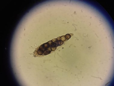 Demodex parazit köpek ya da insanların cilt altında almak fotoğraf--dan mikroskop