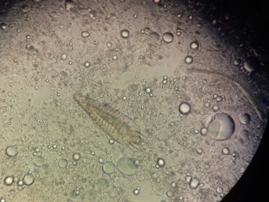 Demodex parazit köpek ya da insanların cilt altında almak fotoğraf--dan mikroskop