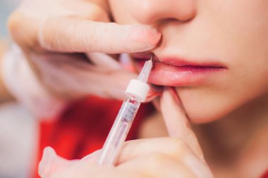 Genç kadın bir enjeksiyon dudaklarını güzellik salonu içinde alır. Güzellik enjeksiyonları-Şevval özçelik güzellik ofiste yatan kadın. Dudaklar hyaluronik asit, yordam, yeniden canlandırılması şekillendirme artırmak