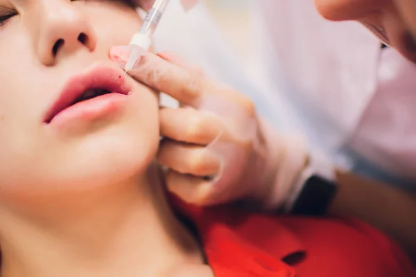 Junge Frau bekommt im Schönheitssalon eine Spritze in die Lippen. Schönheitsinjektionen - Frau liegt im Kosmetikbüro. Steigerung der Lippen durch Hyaluronsäure, Umformung, Revitalisierung — Stockfoto