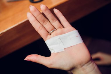 İlk yardım sıva ile el