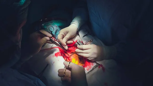Orvosi csapat sebészek a kórházban csinál minimális invazív sebészeti beavatkozások. Sebészeti műtő áramszedő berendezéssel kardiovaszkuláris sürgősségi sebészeti központ számára. — Stock Fotó