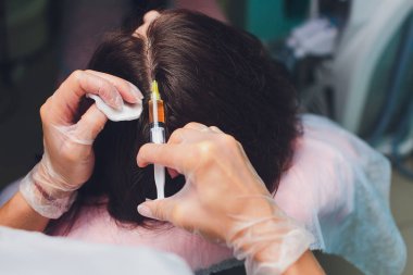 Trombosit zengin plazma enjeksiyon prosedürü. Saç büyüme stimülasyon. PRP tedavisi işlemi.