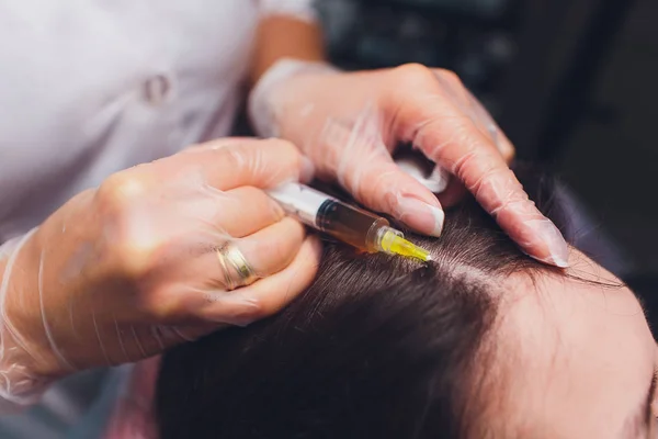 Procedura di iniezione di plasma ricco di piastrine. Stimolazione della crescita dei capelli. Processo di terapia PRP . — Foto Stock