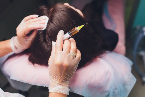 Procedura di iniezione di plasma ricco di piastrine. Stimolazione della crescita dei capelli. Processo di terapia PRP . — Foto Stock