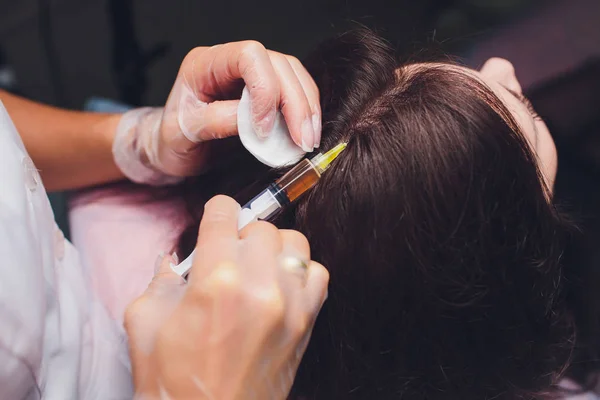 Procedimento de injeção de plasma rico em plaquetas. Estimulação do crescimento do cabelo. Processo de terapia PRP . — Fotografia de Stock