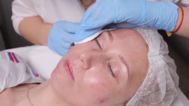Estetista che fa l'iniezione in faccia alle donne, primo piano. Procedura di biorivitalizzazione . — Video Stock