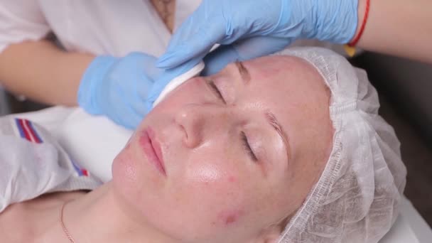 美容师在女人脸上打针特写镜头生物均衡化程序. — 图库视频影像