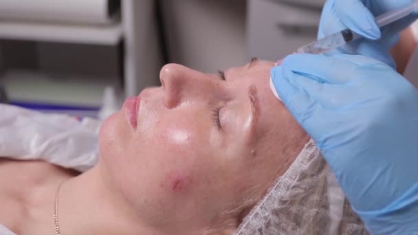 Esteticista haciendo inyección en la cara de las mujeres, primer plano. Procedimiento de biorevitalización . — Vídeo de stock