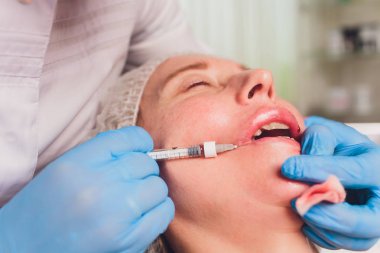 Doktor kozmetik uzmanı güzellik salonunda güzel bir kadının dudak büyütme prosedürünü yapıyor. Kozmetik cilt bakımı..