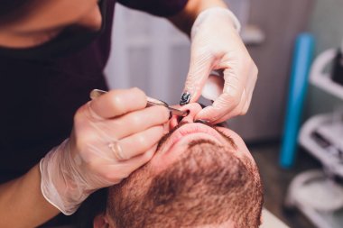 Epilasyon. Mans kanepedeki kozmetolojide sugaring epilationsy sarı renk, yüz. burun içinde epilasyon.