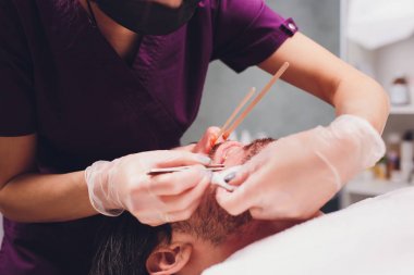 Epilasyon. Mans kanepedeki kozmetolojide sugaring epilationsy sarı renk, yüz. burun içinde epilasyon.