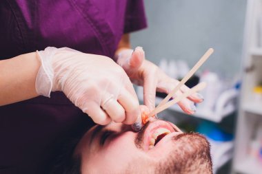 Epilasyon. Mans kanepedeki kozmetolojide sugaring epilationsy sarı renk, yüz. burun içinde epilasyon.