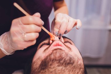 Epilasyon. Mans kanepedeki kozmetolojide sugaring epilationsy sarı renk, yüz. burun içinde epilasyon.