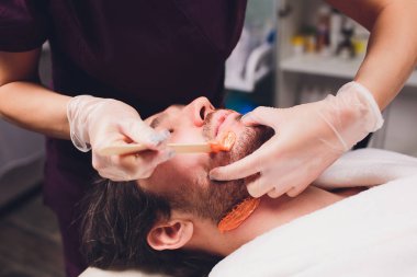 Epilasyon. Mans yüze sugaring epilations sakal kırpma, sarı renk, kozmetik içinde bu kanepe.