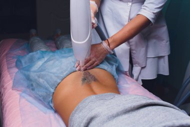 Kuaförde hasta ve profesyonel dövme silme lazeri olan bir kozmetolog..