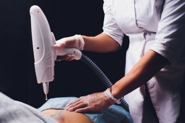 Kuaförde hasta ve profesyonel dövme silme lazeri olan bir kozmetolog..