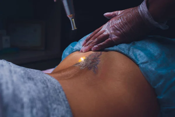 Cosmetologo con laser di rimozione del tatuaggio paziente e professionale nel salone . — Foto Stock