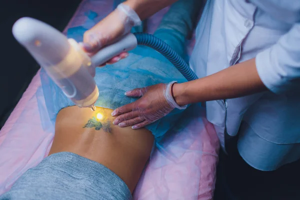 Kosmetologi potilaan ja ammatillinen tatuointi poisto laser salonki . — kuvapankkivalokuva