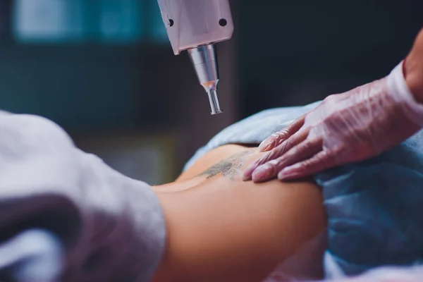 Cosmetologo con laser di rimozione del tatuaggio paziente e professionale nel salone . — Foto Stock