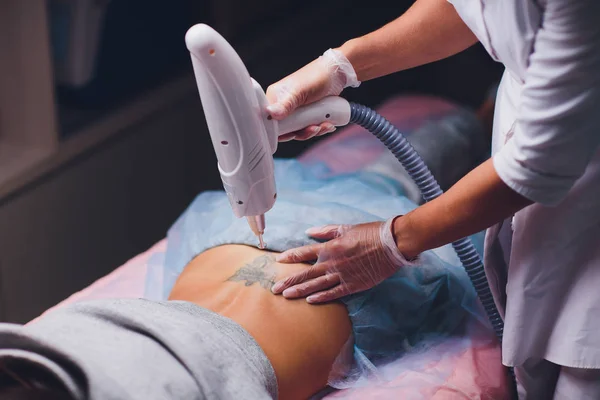 Cosmetologist with patient and professional tattoo removal laser in salon. — Stock Photo, Image