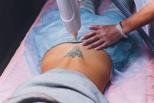 Kosmetolog s pacientem a profesionálním laserem na odstranění tetování v salonu. — Stock fotografie