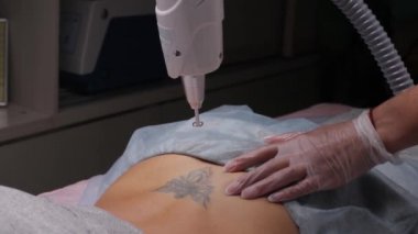 Kuaförde hasta ve profesyonel dövme silme lazeri olan bir kozmetolog..