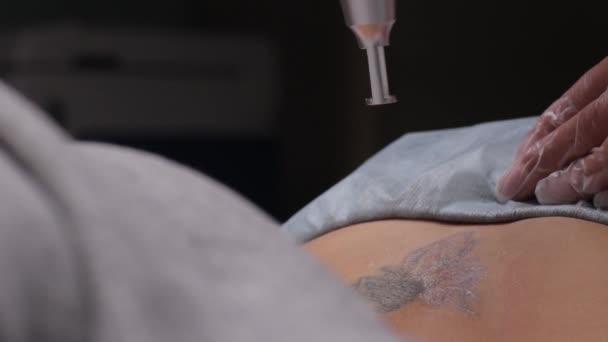 Cosmetologue avec laser de retrait de tatouage patient et professionnel dans le salon . — Video