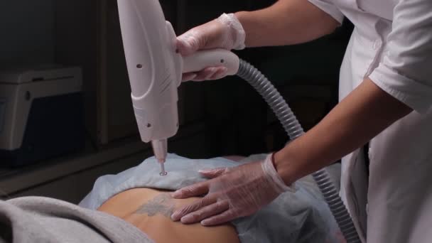 Cosmetoloog met patiënt en professionele tatoeage verwijderen laser in salon. — Stockvideo