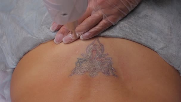 Cosmetólogo con láser de eliminación de tatuajes profesional y paciente en el salón . — Vídeo de stock