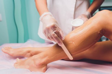 Lazer epilasyon prosedürü önce kişi bir jel uygulanıyor. Uygulama şeker yapıştırın shugaring yordam için.