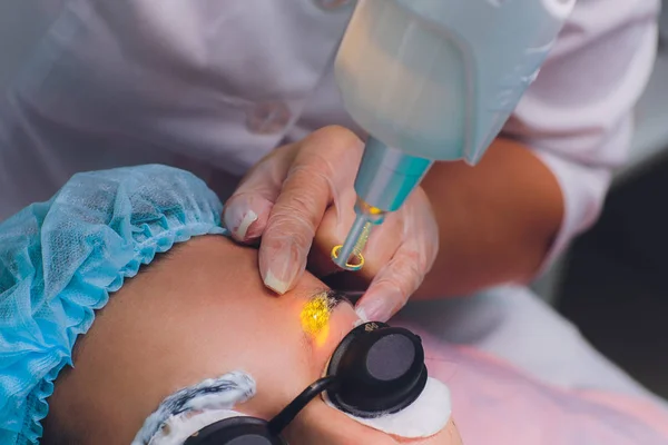 Laser verwijdering van een permanente make-up op een gezicht. Closeup jonge vrouw ontvangen van correctie van een tatoeage op wenkbrauwen procedure. Correctie van natuurlijke onvolkomenheden op een gezicht. — Stockfoto