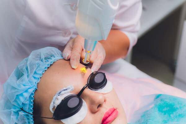 Laser removal of a permanent make-up on a face. Closeup young woman receiving correction of a tattoo on eyebrows procedure. Correction of natural imperfections on a face.