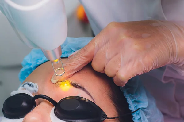 Enlèvement laser d'un maquillage permanent sur un visage. Gros plan jeune femme recevant la correction d'un tatouage sur les sourcils procédure. Correction d'imperfections naturelles sur un visage . — Photo