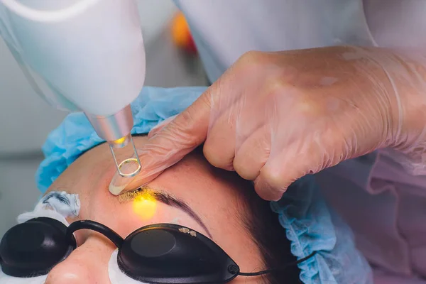 Remoção a laser de uma maquilagem permanente em uma cara. Feche a mulher jovem que recebe a correção de uma tatuagem no procedimento de sobrancelhas. Correção de imperfeições naturais em uma cara . — Fotografia de Stock