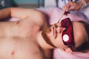 Master doktor kalıcı olarak istenmeyen yüz saç lazer ile sakallı adam kaldırma işlemi gerçekleştirir. Sağlık ve güzellik.