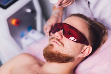 Master doktor kalıcı olarak istenmeyen yüz saç lazer ile sakallı adam kaldırma işlemi gerçekleştirir. Sağlık ve güzellik.