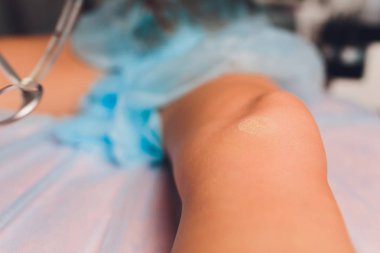 Sağlık Güzellik lazer cosmeology yordam. Salonunda genç kadın. Profesyonel doktor. Kadın Cilt Bakımı teknolojisi. yara izi kaldırma.