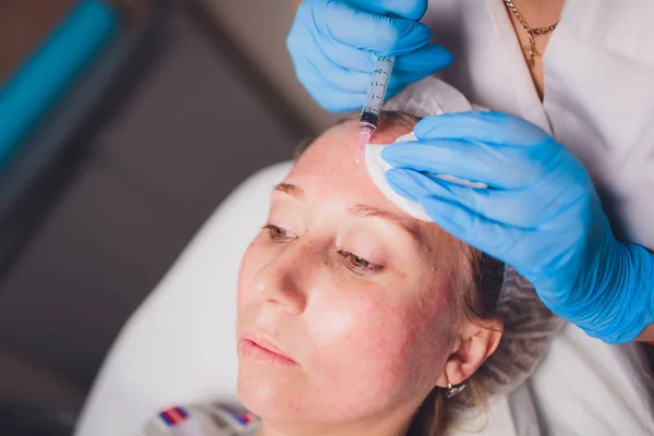 Esteticista haciendo inyección en la cara de las mujeres, primer plano. Procedimiento de biorevitalización . — Foto de Stock