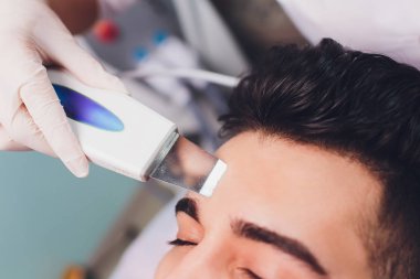 Ultrasonik yüz Temizleme. Beyaz delikanlı, kozmetik.