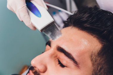 Ultrasonik yüz Temizleme. Beyaz delikanlı, kozmetik.