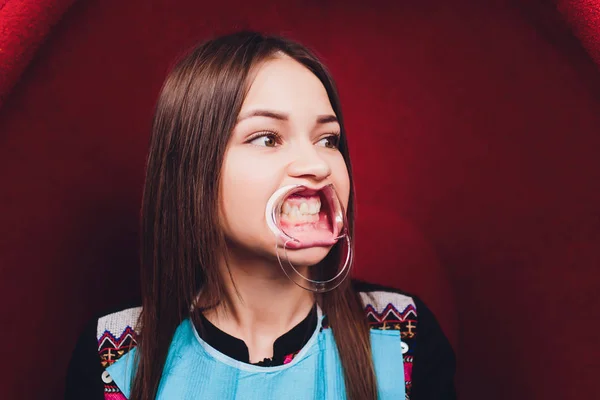 Közelről a női száj és övvisszahúzó. Orvos fogselyem a fogak. Fogászati gag. — Stock Fotó