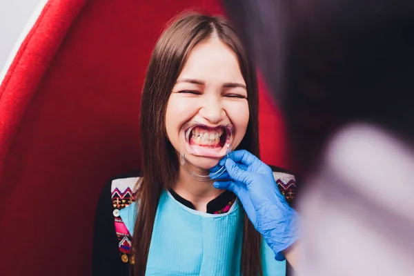 Primo piano della bocca femminile con riavvolgitore. Il dottore sta facendo il filo interdentale. Gag dentale . — Foto Stock