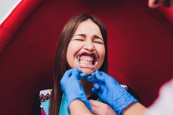 Primo piano della bocca femminile con riavvolgitore. Il dottore sta facendo il filo interdentale. Gag dentale . — Foto Stock
