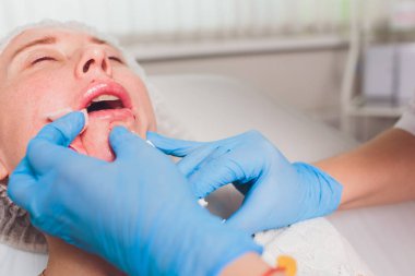 Doktor kozmetik uzmanı güzellik salonunda güzel bir kadının dudak büyütme prosedürünü yapıyor. Kozmetik cilt bakımı..