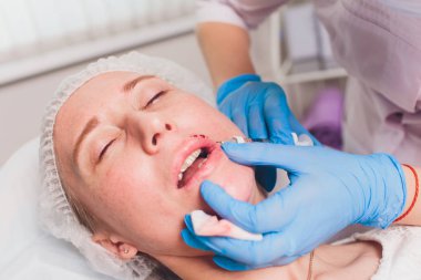 Doktor kozmetik uzmanı güzellik salonunda güzel bir kadının dudak büyütme prosedürünü yapıyor. Kozmetik cilt bakımı..