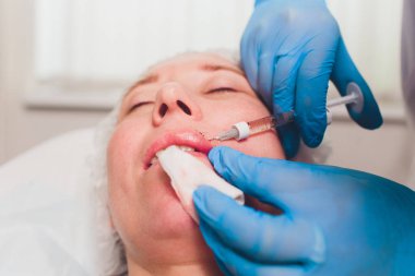 Doktor kozmetik uzmanı güzellik salonunda güzel bir kadının dudak büyütme prosedürünü yapıyor. Kozmetik cilt bakımı..