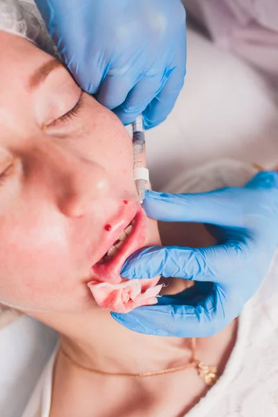 Dokter kosmetolog membuat Lip augmentasi prosedur seorang wanita cantik di salon kecantikan. Kosmetologi perawatan kulit. — Stok Foto