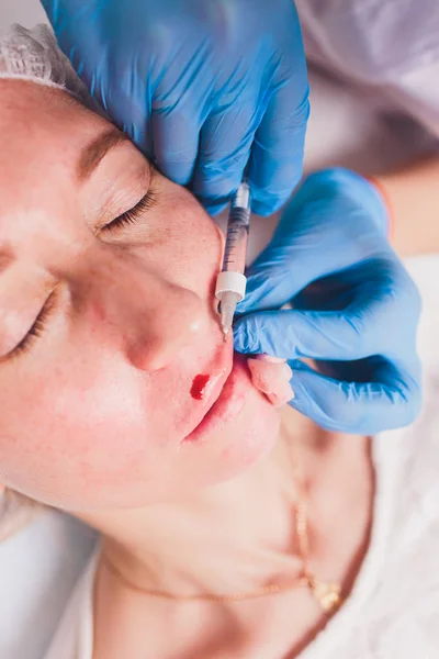 Dokter kosmetolog membuat Lip augmentasi prosedur seorang wanita cantik di salon kecantikan. Kosmetologi perawatan kulit. — Stok Foto